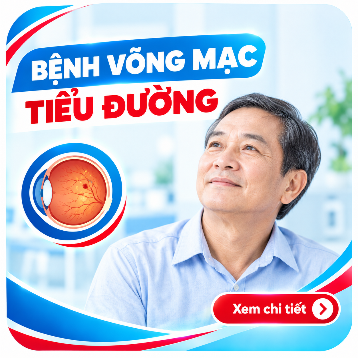 Bệnh Võng Mạc Tiểu Đường